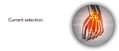 hand & wrist joint conditions treatment in chembur mumbai