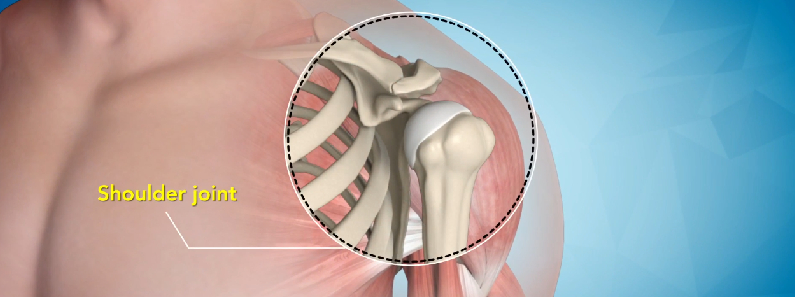 shoulder joint replacement surgery in chembur mumbai